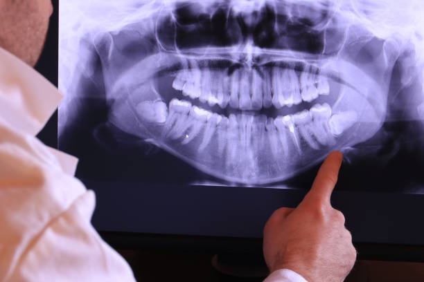 Best Same-Day Emergency Dental Services in Pottsboro, TX