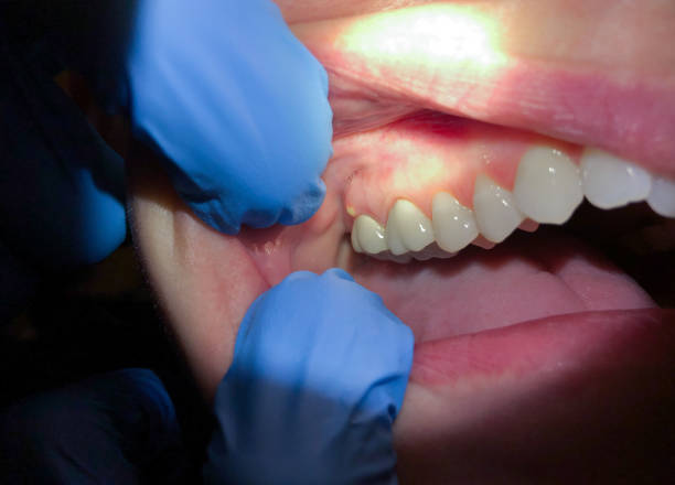 Best After-Hours Dental Trauma Care in Pottsboro, TX