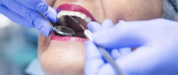 Best Emergency Dental Care for Broken or Chipped Teeth in Pottsboro, TX